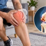 Knee Bone Spur Key Facts & What to Know
